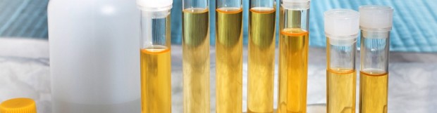 Liquid Gold or Reimbursement Trap? Payor Reimbursement Policies for Urine Drug Testing